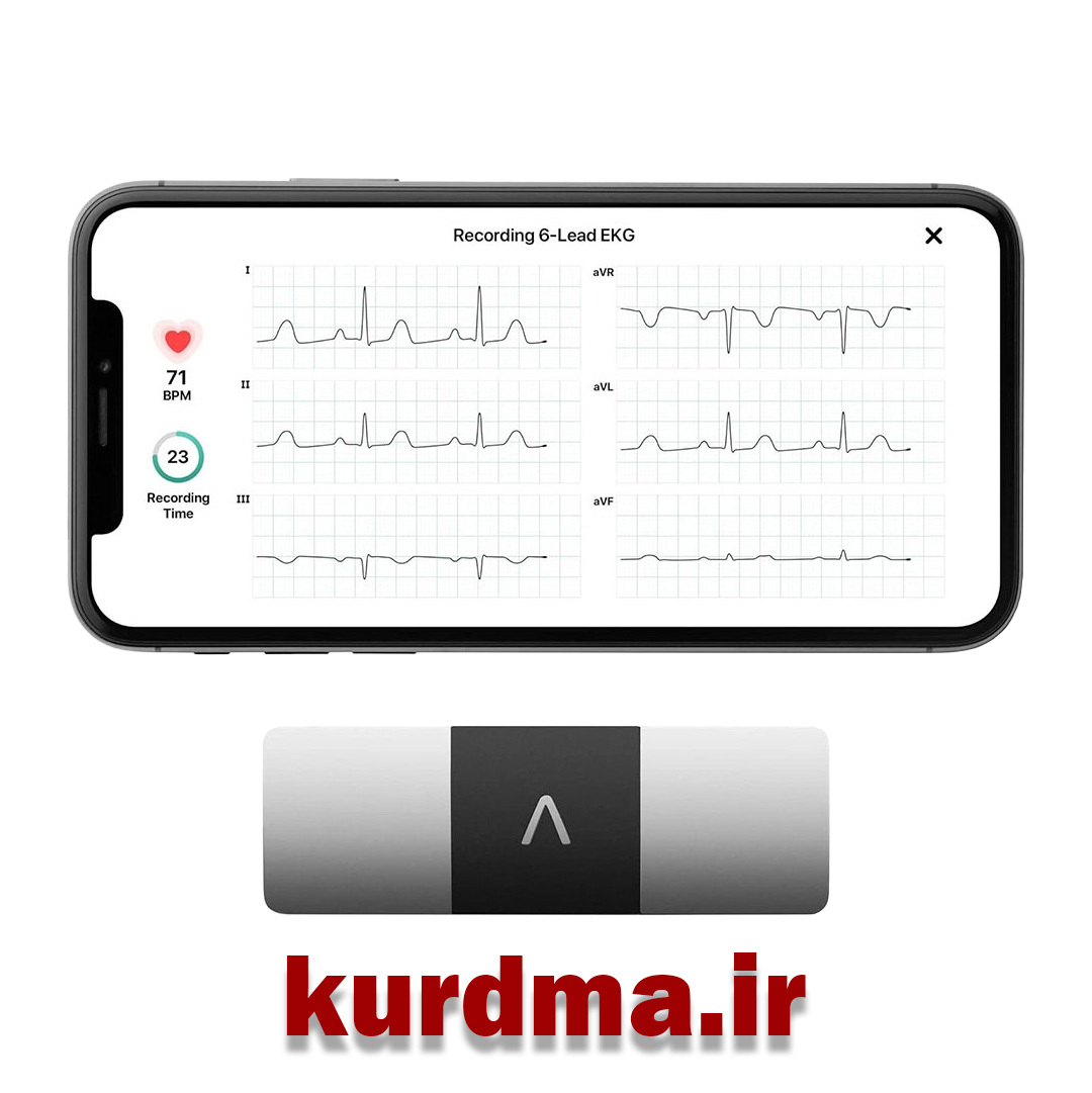  دستگاه نوار قلب قابل حمل برند Alive Cor KardiaMobile 6L 