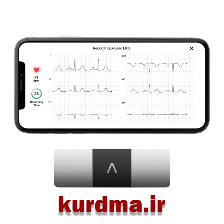دستگاه نوار قلب قابل حمل برند Alive Cor KardiaMobile 6L