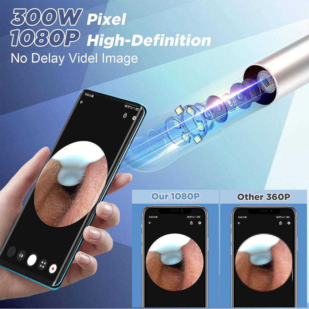  اتوسکوپ پاک کننده جرم گوش Earwax اورجینال 